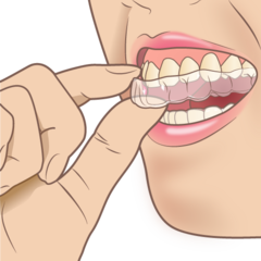 mouthpiece_orthodontic_コピー