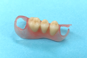 ノンクラスプデンチャー