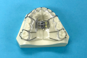 子供 プレート矯正2